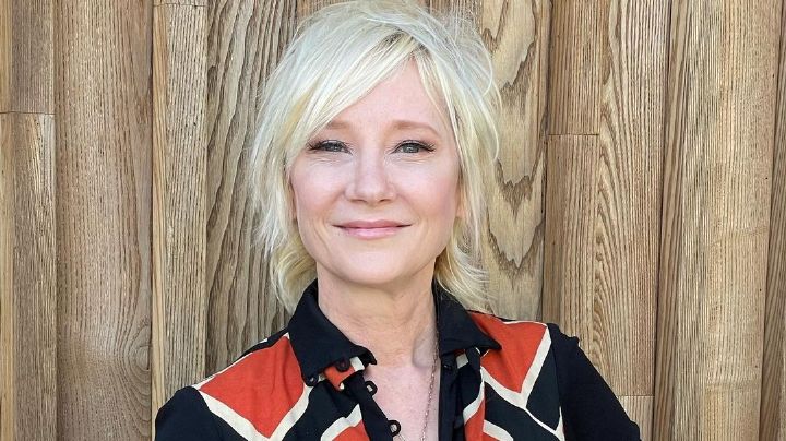 Anne Heche en COMA: tiene graves quemaduras en todo su cuerpo, dice su representante