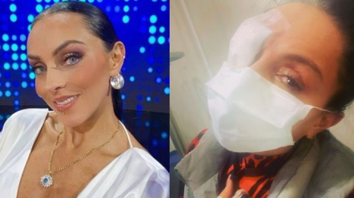 Ivonne Montero confiesa que tiene fuertes secuelas tras quemarse las córneas