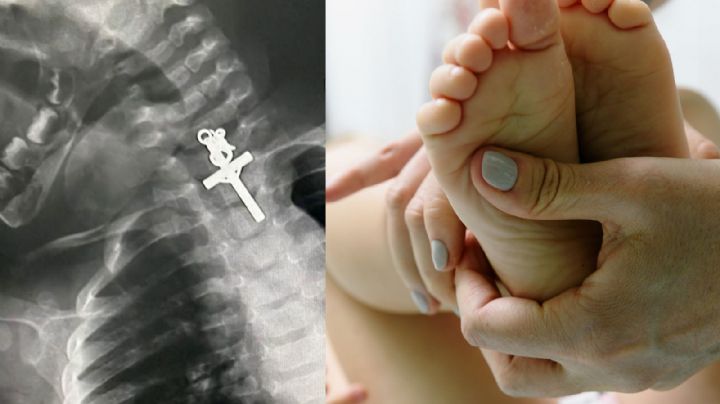 Viral: Doctores hallan crucifijo en garganta de una bebé, así lo descubrieron en radiografía